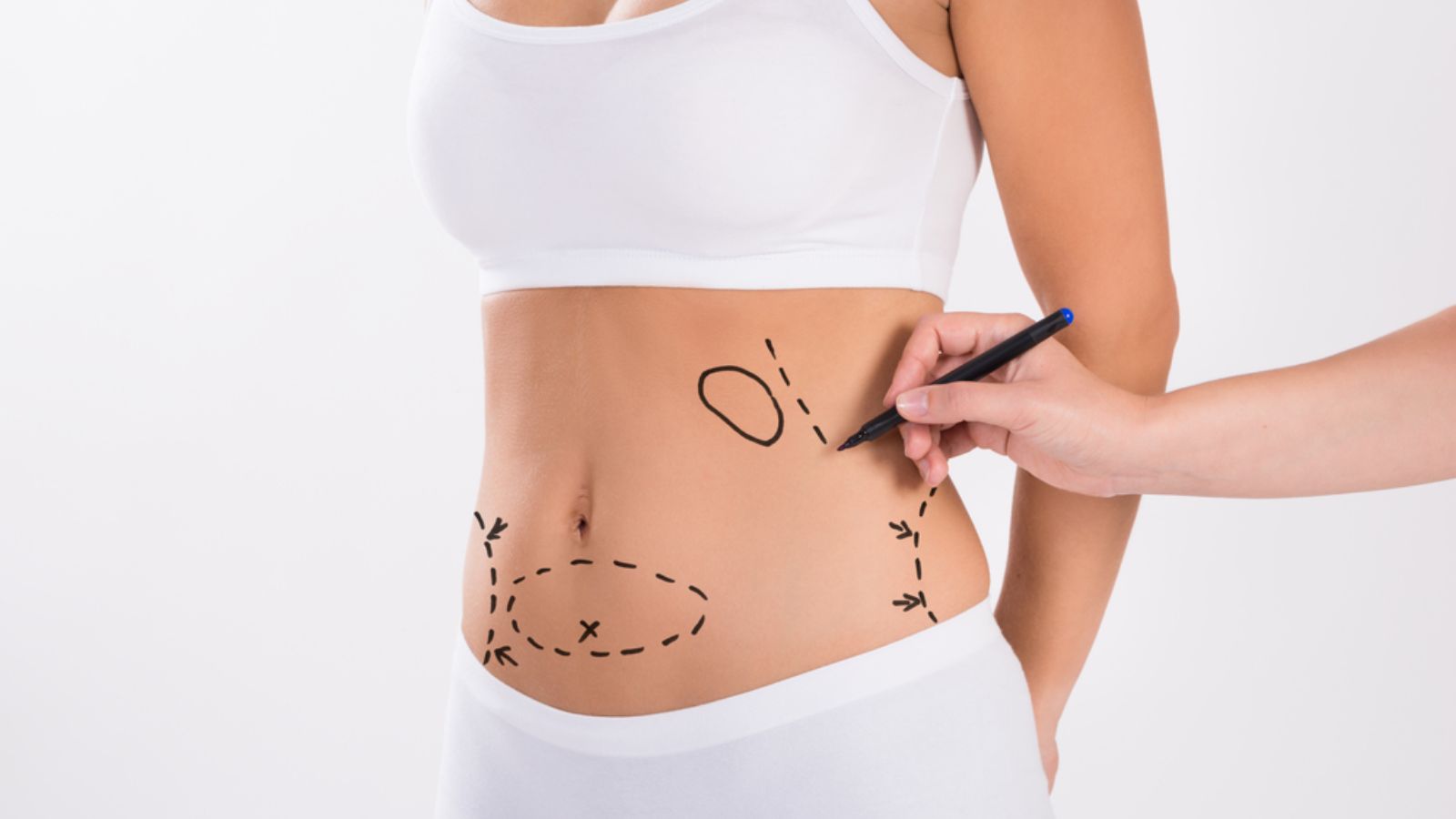 How to Maintain Liposuction Results Long-Term