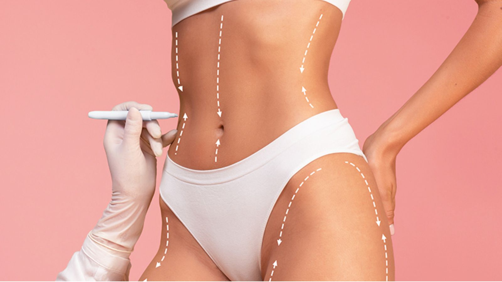 VASER vs Laser Liposuction – Which Is Best for You
