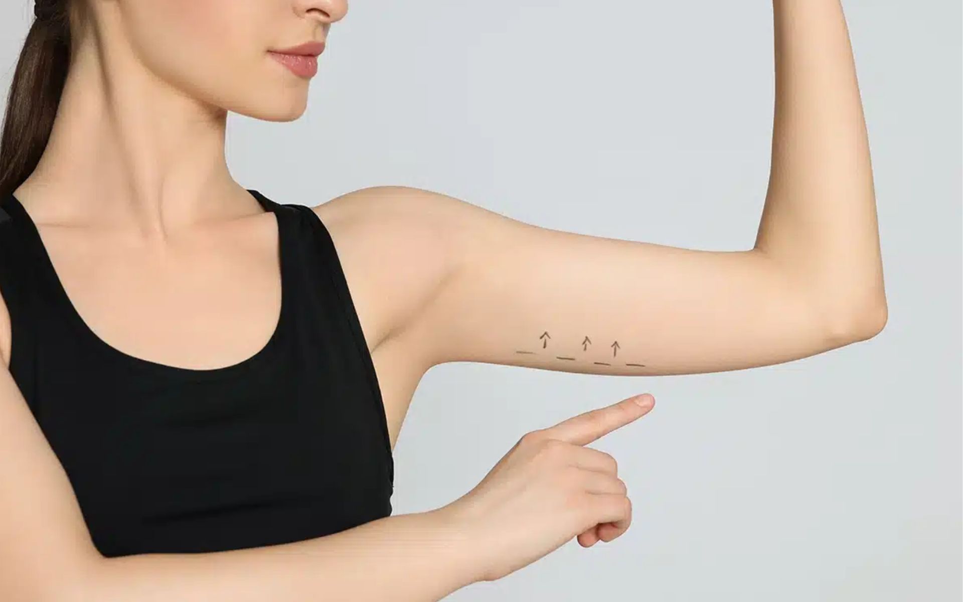 Arm Lift Surgery Recovery Timeline: Week-by-Week Guide