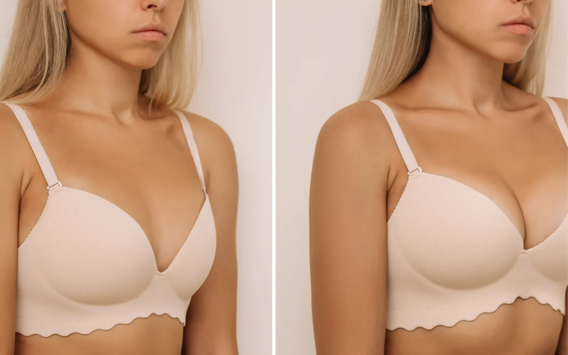Breast Lift vs Breast Reduction Differences, Benefits & Which is Right