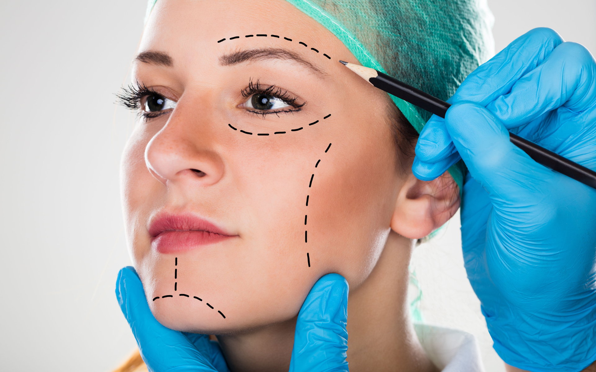 Facelift Surgery in India Benefits, Procedure, Recovery & Results