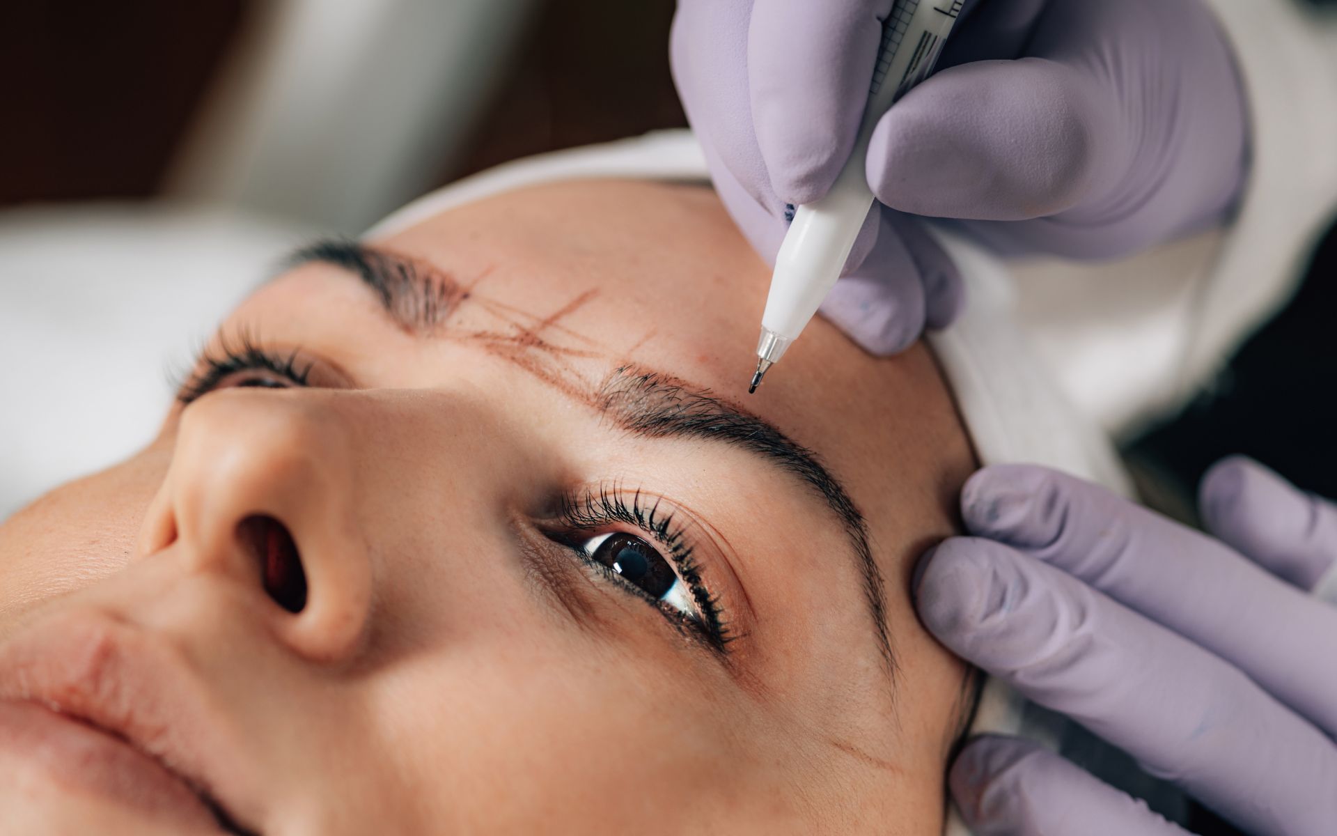 Brow Lift Surgery Techniques, Benefits & Recovery