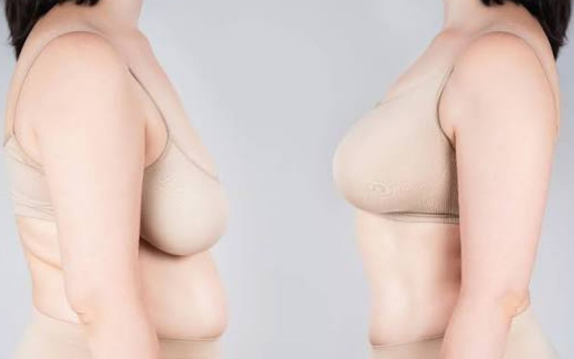 Breast Lift Surgery Benefits, Procedure & Recovery
