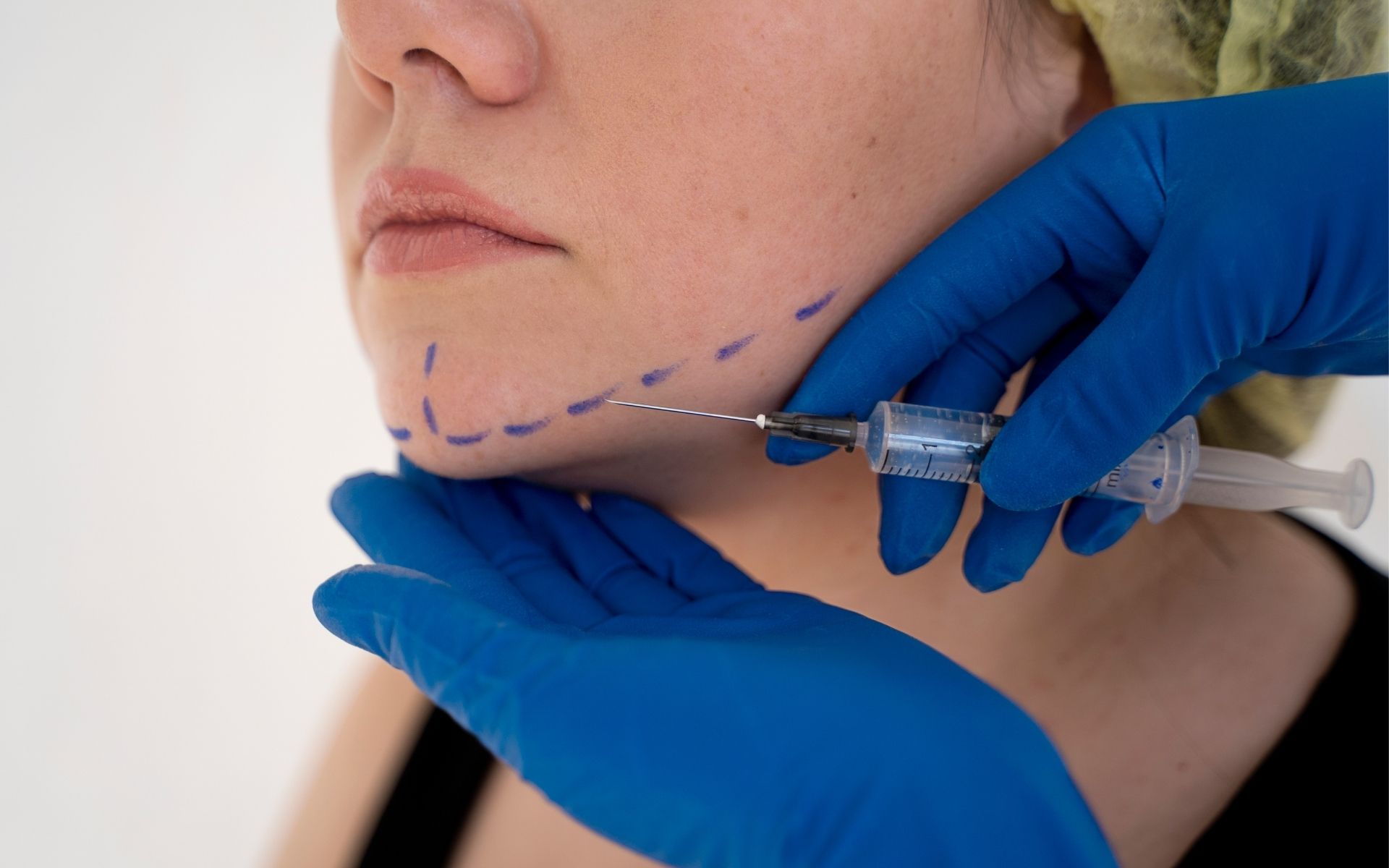 Jaw Contouring Surgery Benefits, Techniques & Recovery