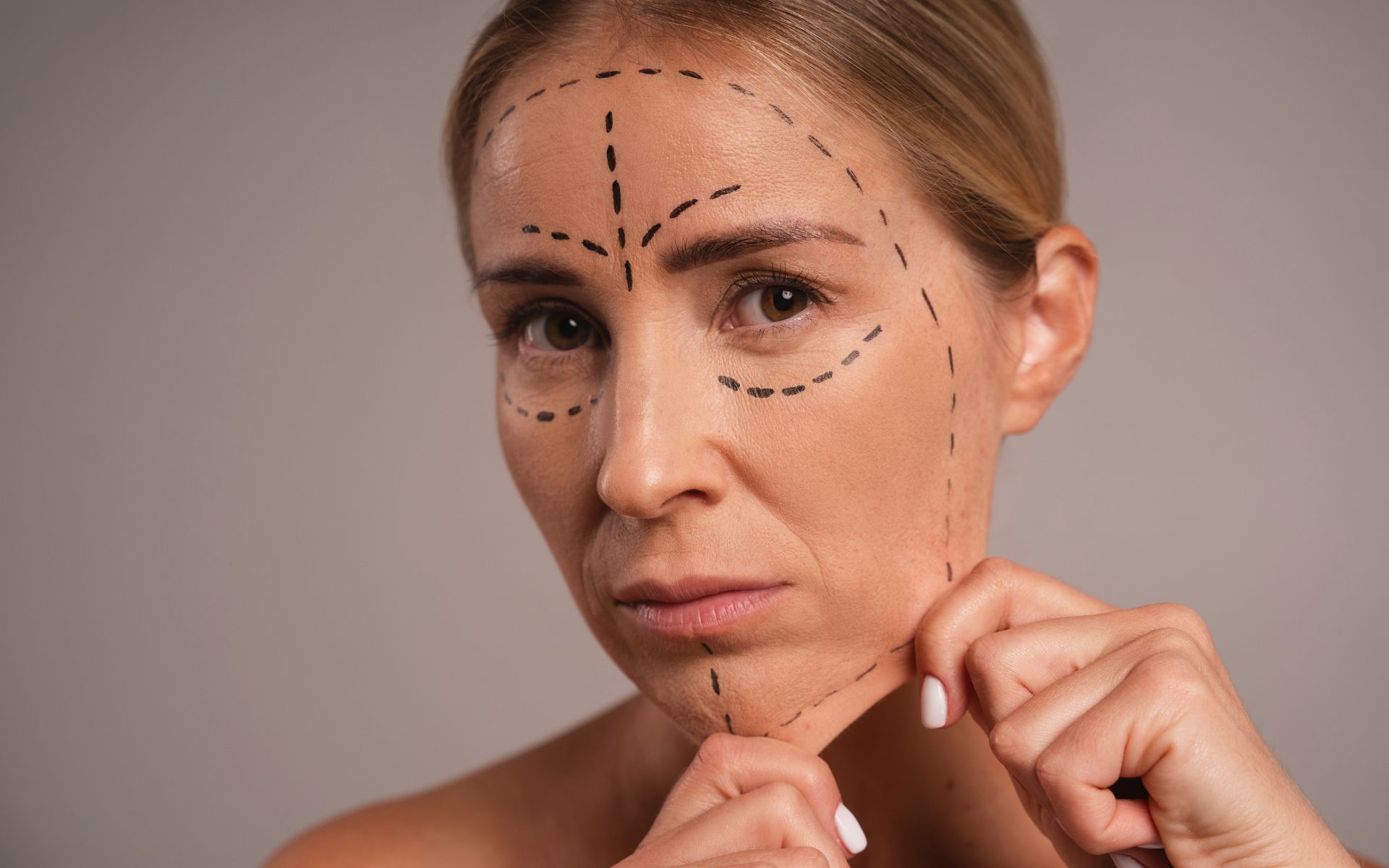 Deep Plane vs SMAS Facelift Key Differences Explained