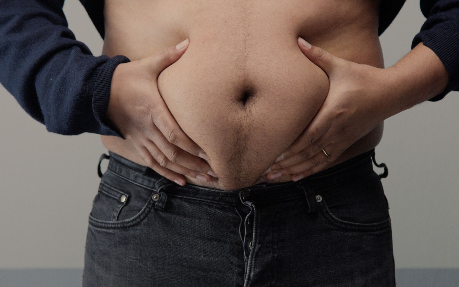 Liposuction for Men Areas, Benefits & Recovery